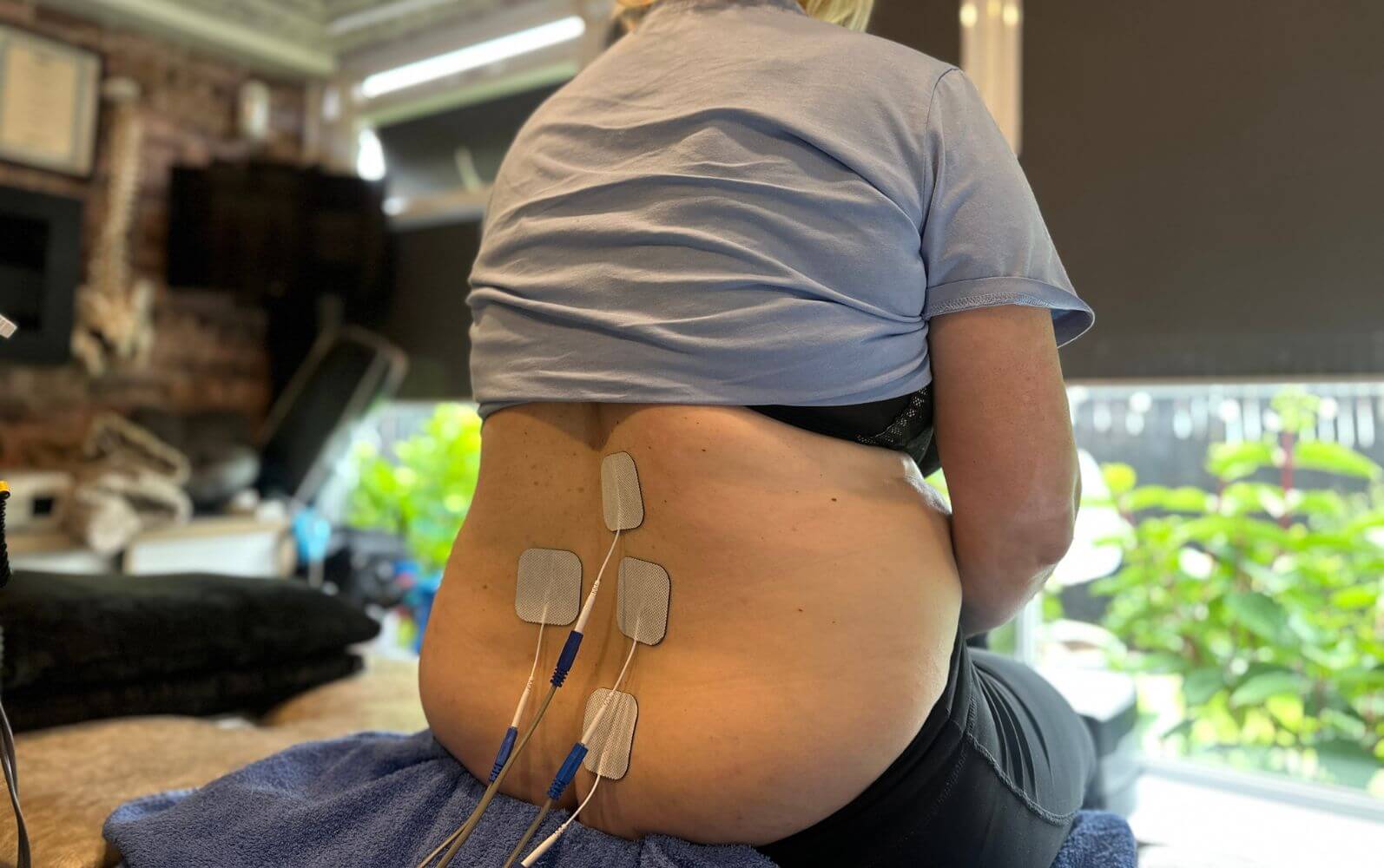 Electrotherapy treatment on lower back at Private Physiotherapy Glasgow Clinic