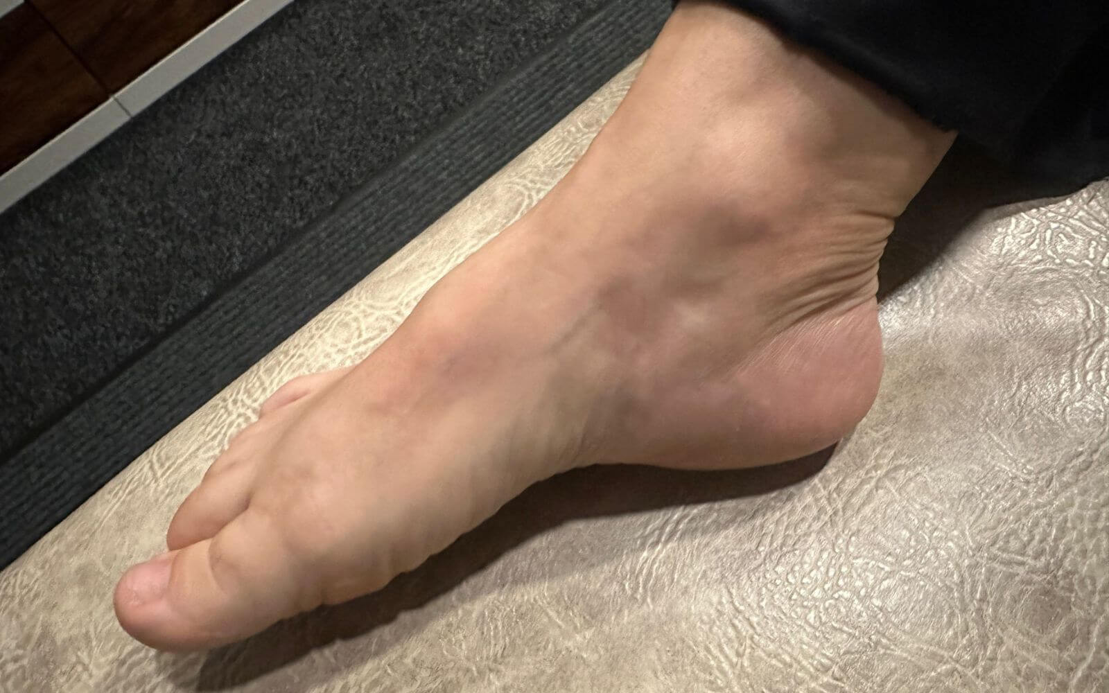 Ankle Sprain Physiotherapy Glasgow