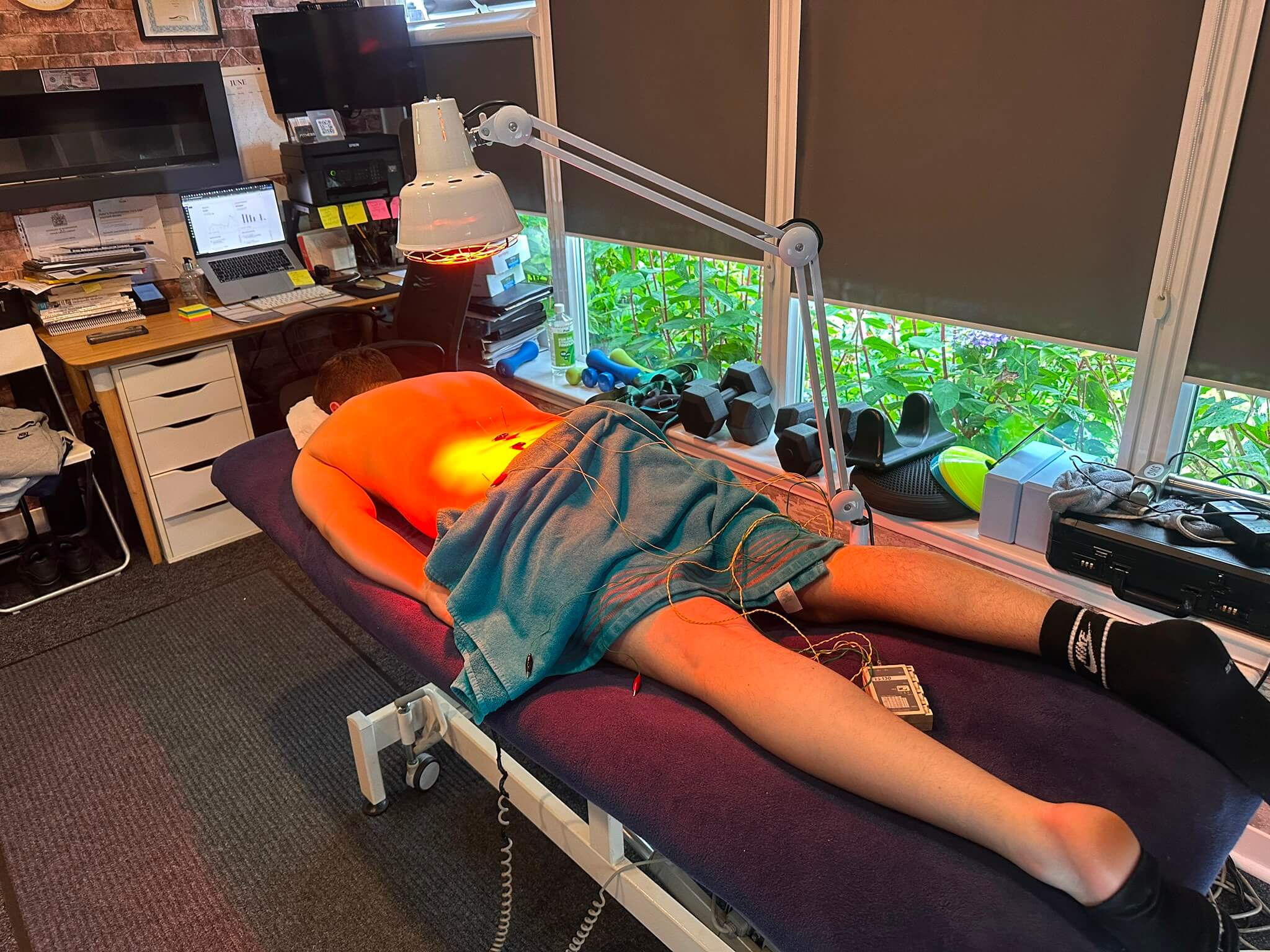 Patient lying on a table during a dry needling session with electrostimulation and a heat lamp. Comprehensive sports physiotherapy Glasgow for treating back and leg injuries.