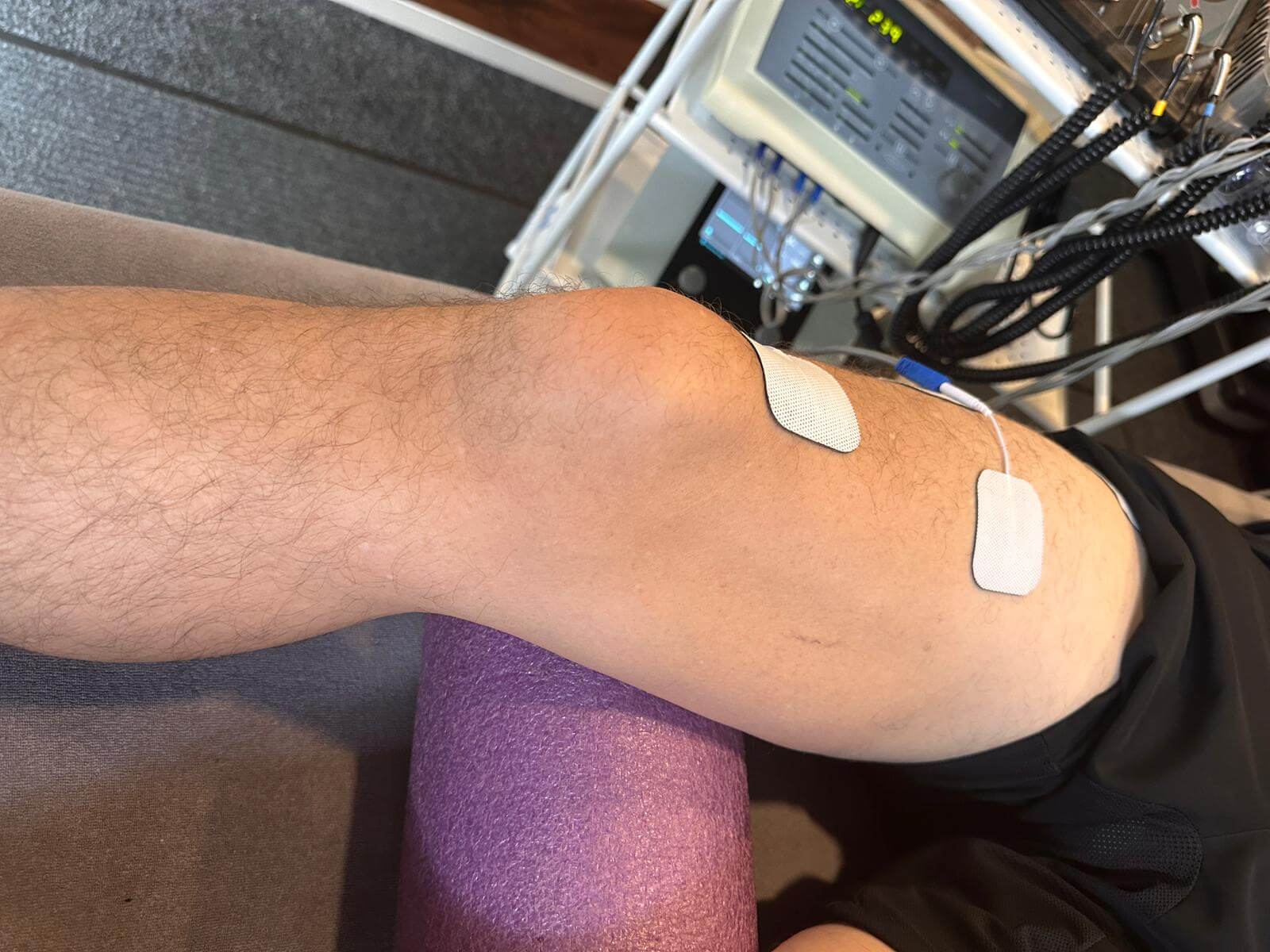 Electrotherapy electrodes applied to knee during knee pain physiotherapy in Glasgow