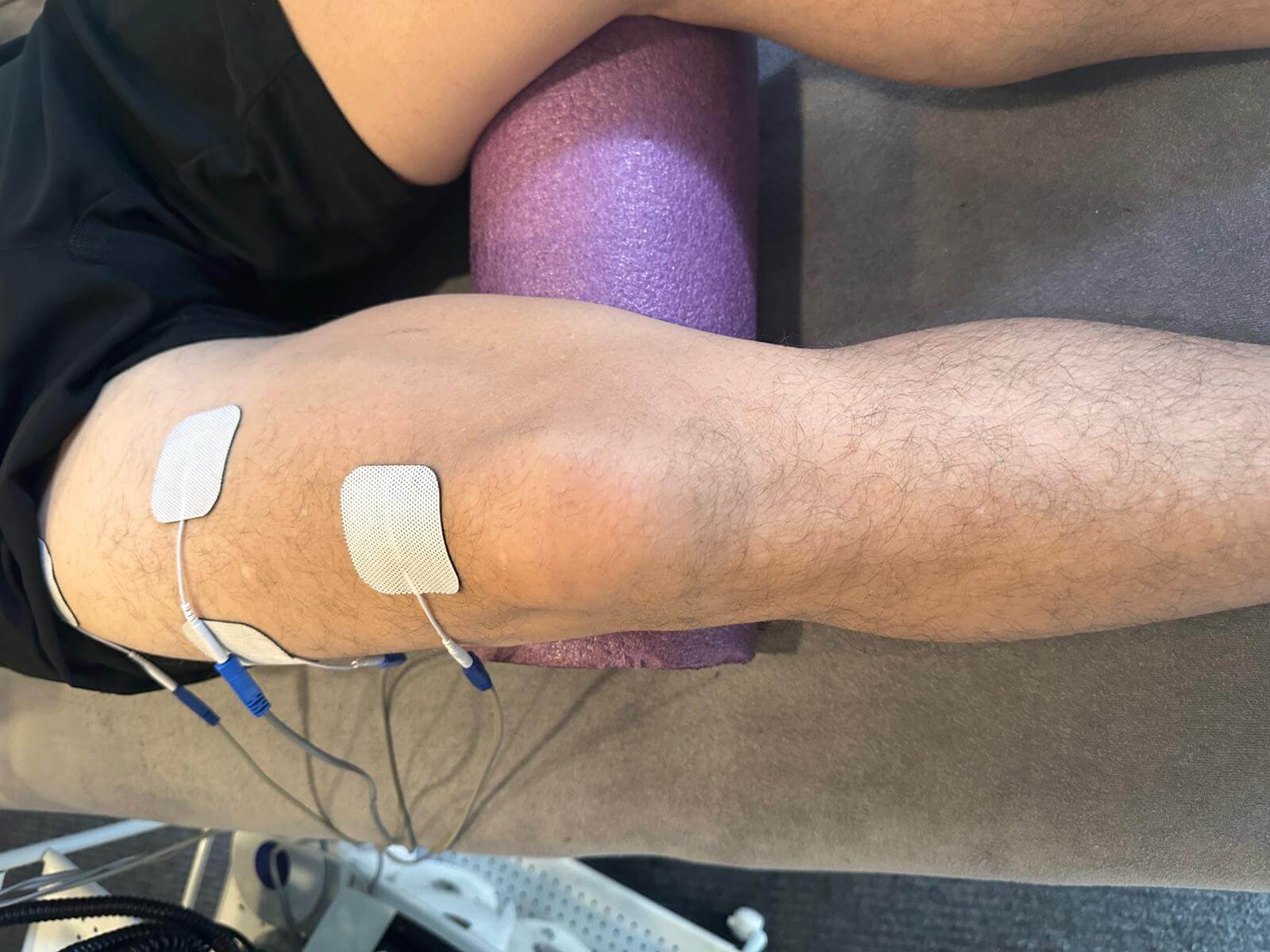 Electrodes placed around knee joint for knee pain treatment at Glasgow physiotherapy clinic